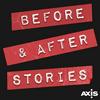 undefined Before And After Stories