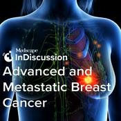 Podcast Medscape InDiscussion: Advanced and Metastatic Breast Cancer